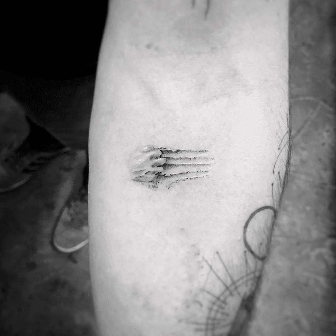 scratches