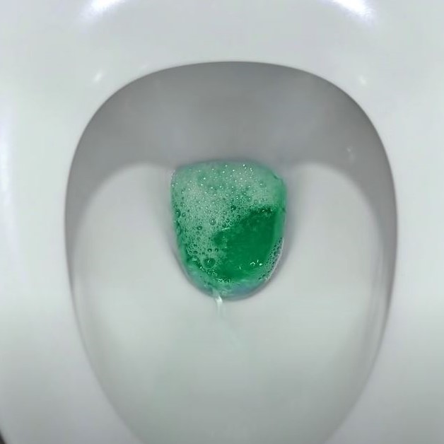 Learn what your urine color says about you