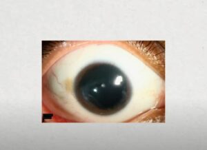 Rarest eye colors in the world explained – and the rarest is not what ...